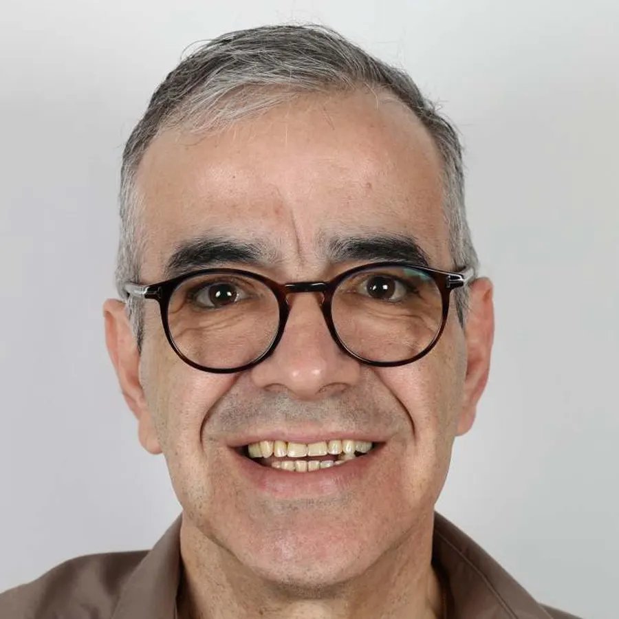 Smile makeover — Before