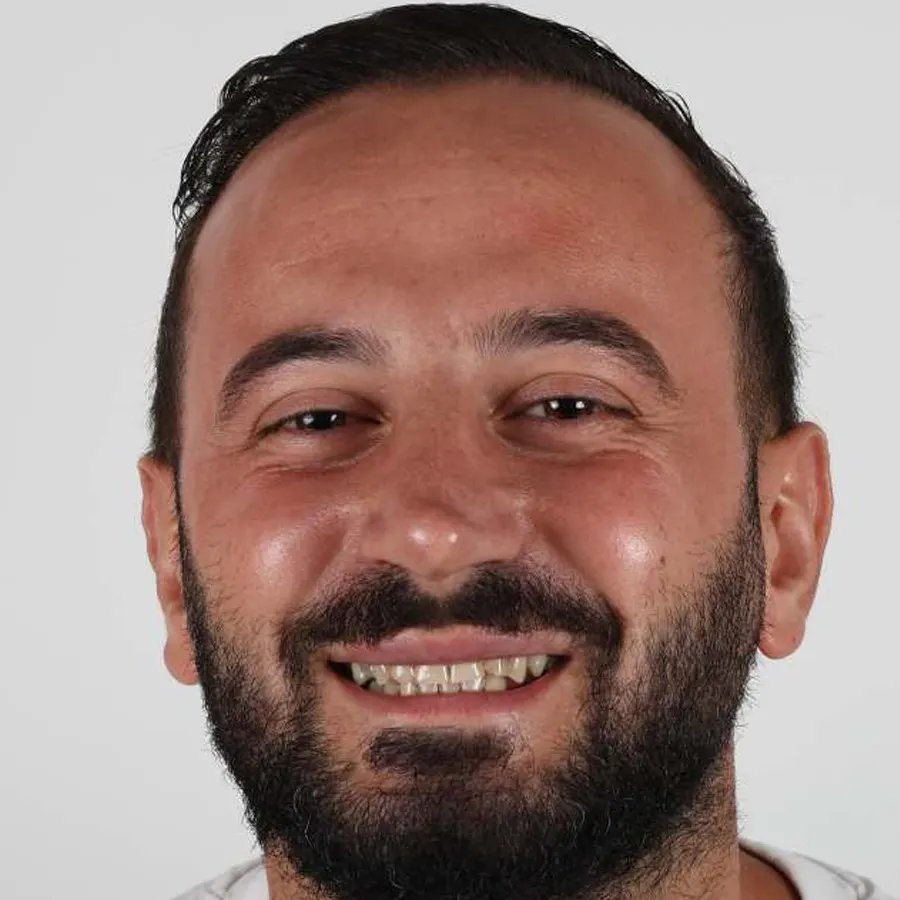 Smile makeover — Before