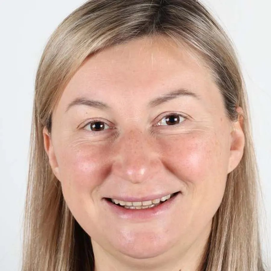 Smile makeover — Before