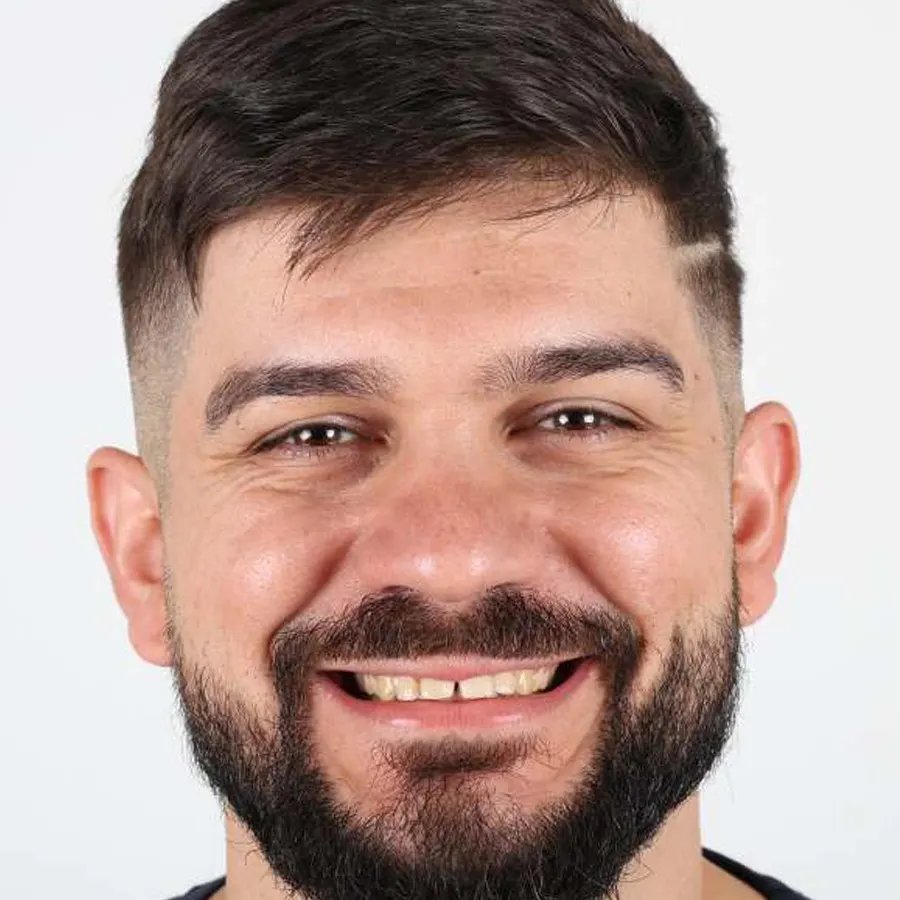Smile makeover — Before
