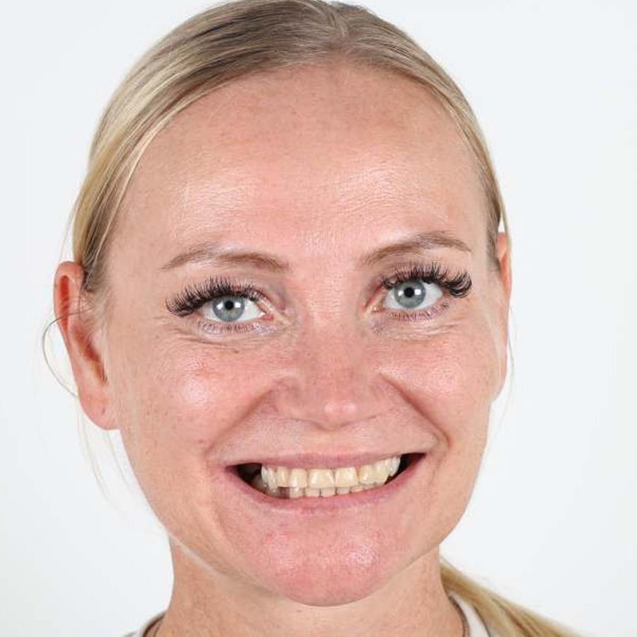 Smile makeover — Before
